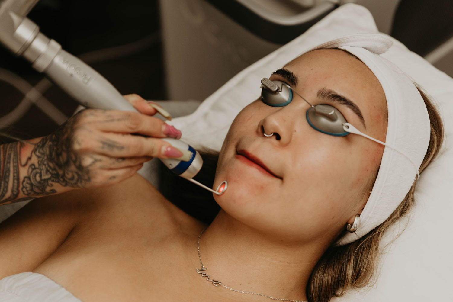 A collagen-stimulating treatment at ARO Med Spa