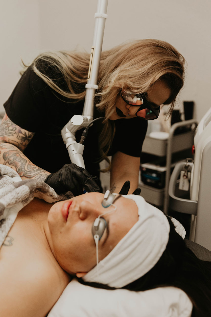 A resurfacing treatment at ARO Med Spa