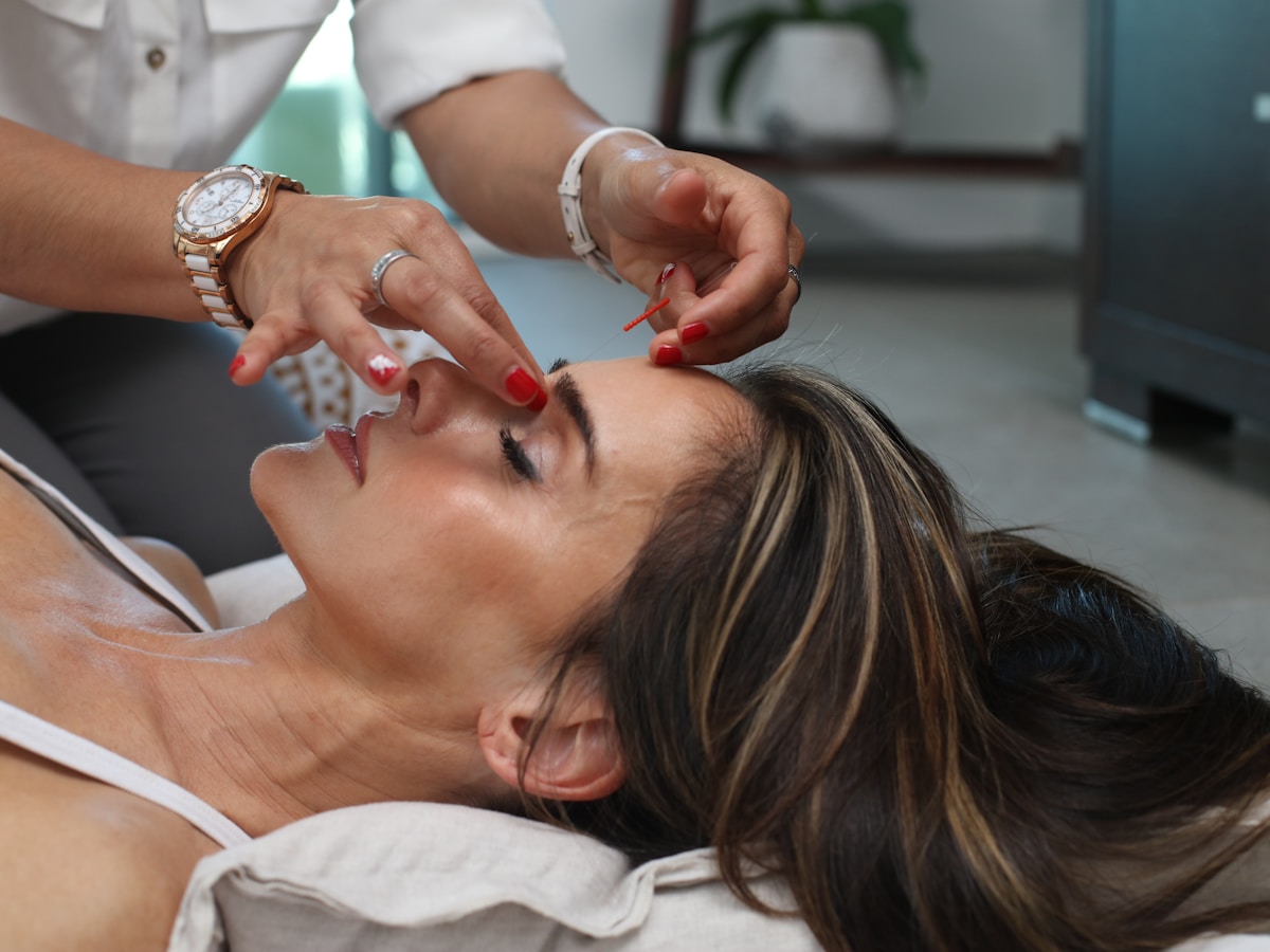 Microneedling treatment at ARO Med Spa